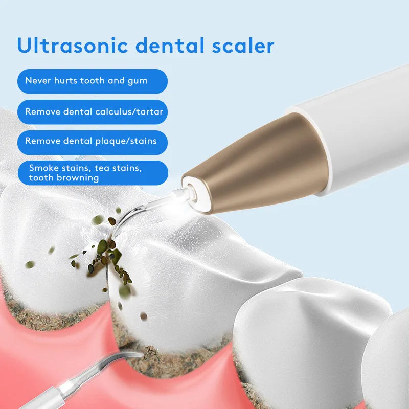 Gold ultrasonic tooth cleaning device for tartar and stain removal