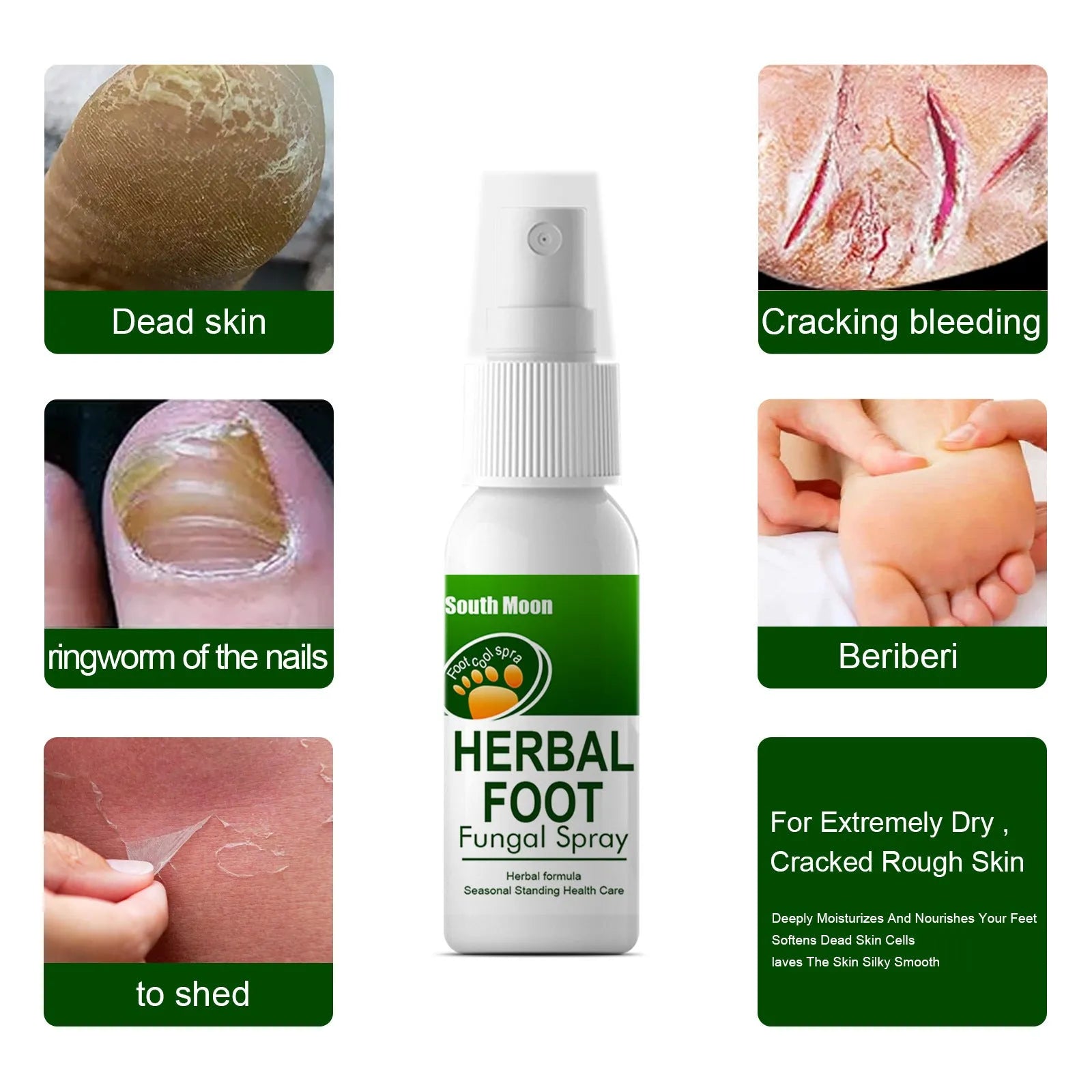 30ml foot nourishing and hydrating care spray in portable spray bottle for cracked heels and dry skin