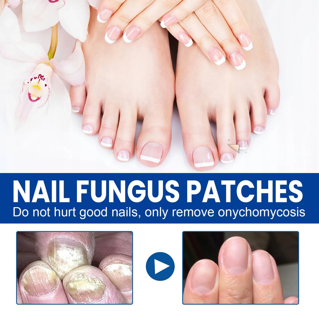 Box of 32 nail nursing adhesive bandage patches for repair, each patch sized 6.1 by 3.5 cm.