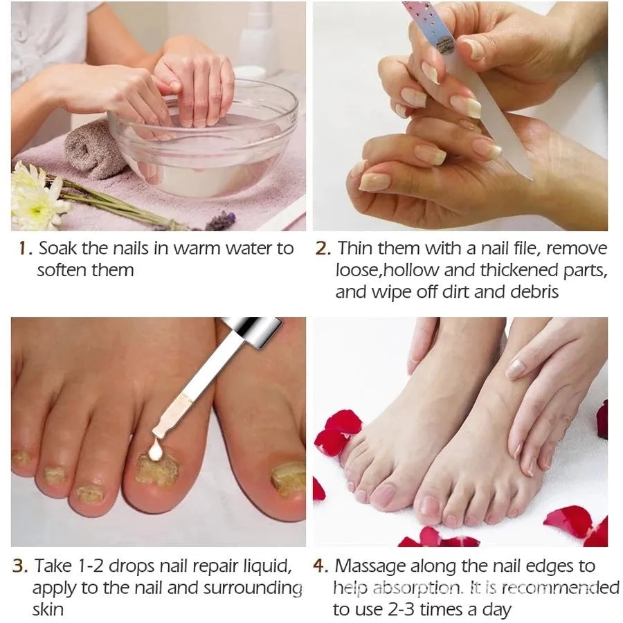 10ml bottle of Jiagou Whitening Antibacterial Liquid for foot treatment