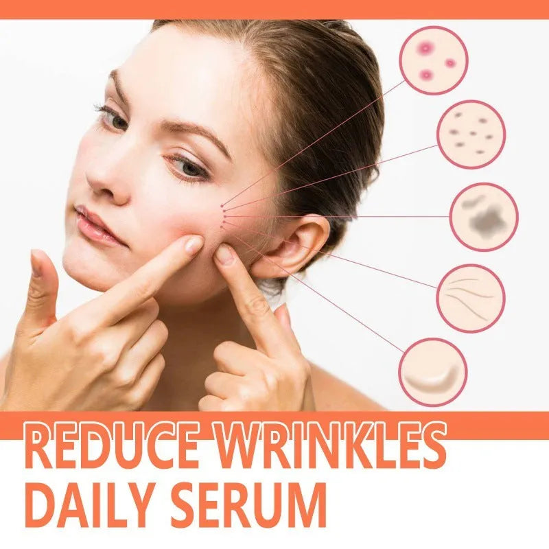 30 ml bottle of rose essential oil for smoothing wrinkles and brightening skin.