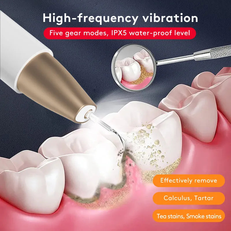 Gold ultrasonic tooth cleaning device for tartar and stain removal