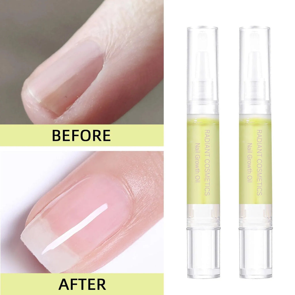 3ml nail growth treatment oil bottle for promoting nail growth and moisturising cuticles