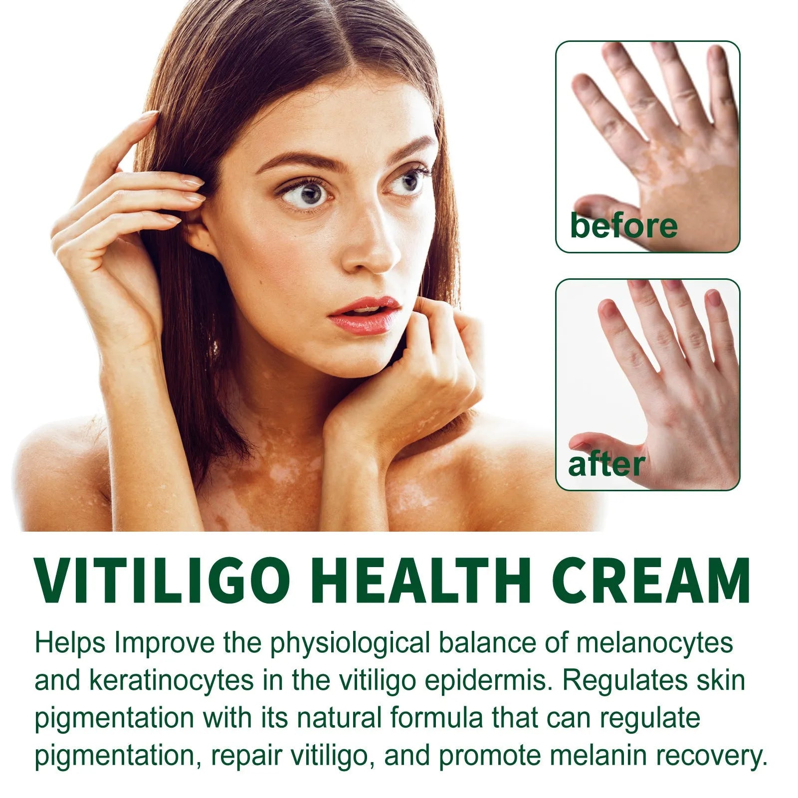 35g jar of nursing cream for body skin cleansing and moisturising.