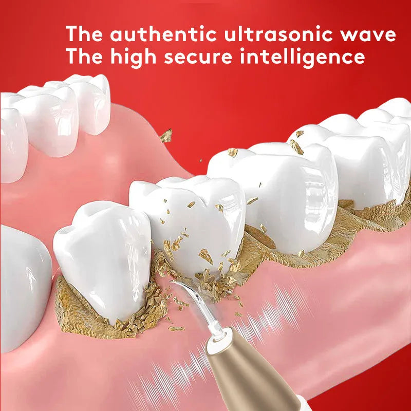 Gold ultrasonic tooth cleaning device for tartar and stain removal